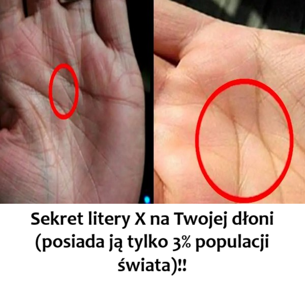 Sekret litery X na Twojej dłoni (posiada ją tylko 3% populacji świata)!!